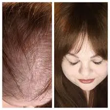 Hair Topper