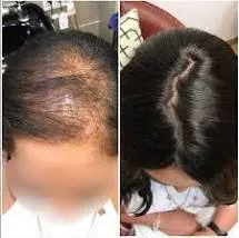 Hair Topper